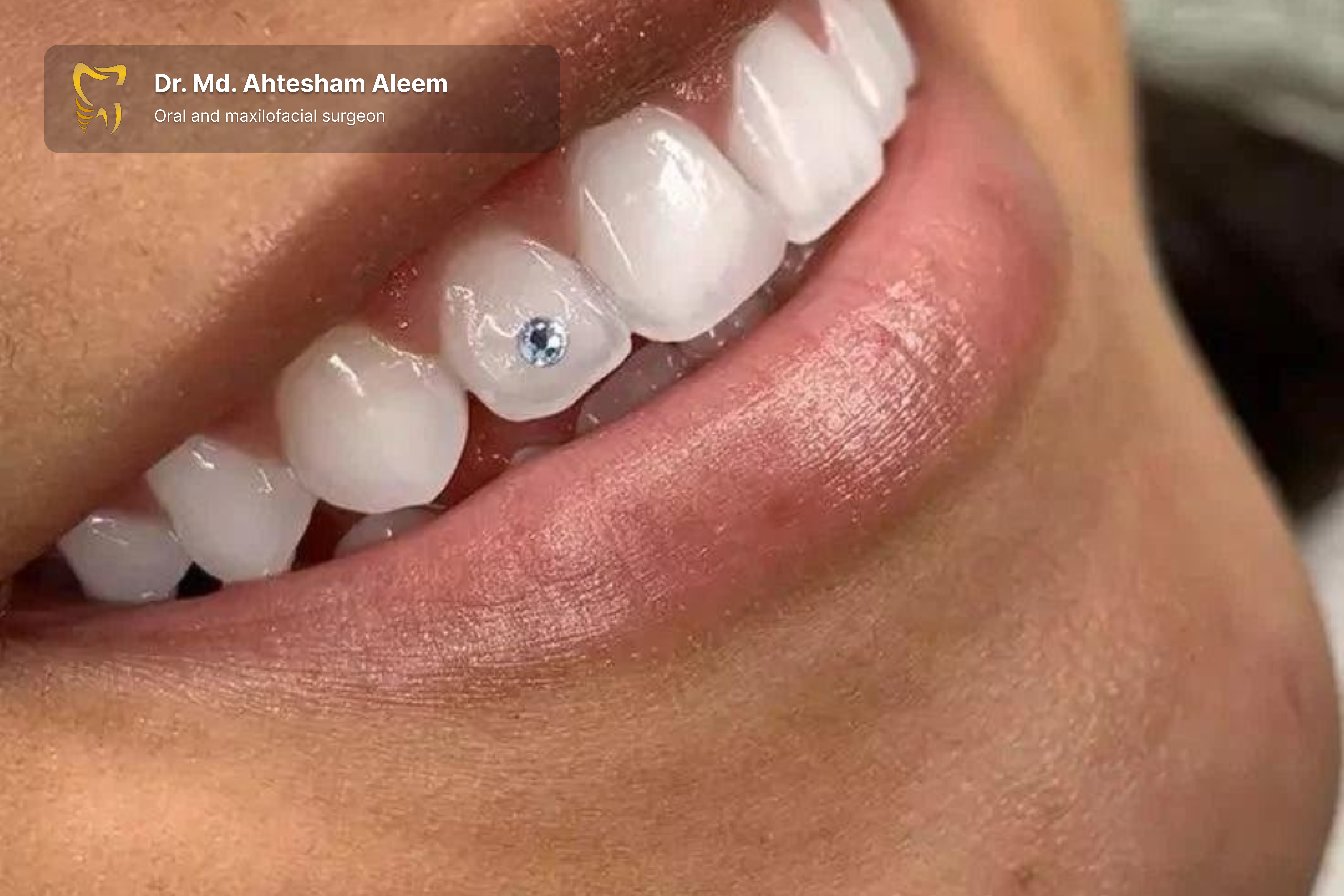 Tooth Jewellery Image 1